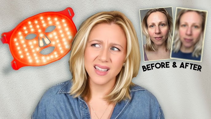 red light therapy before and after