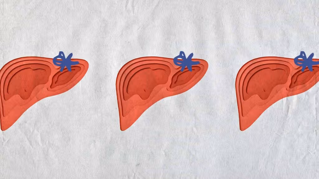 Can Stress Cause Elevated Liver Enzymes?