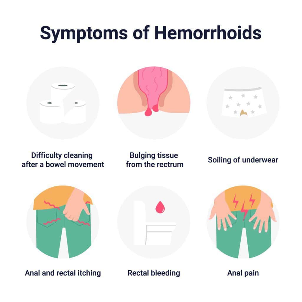 Can Stress Cause Hemorrhoids?