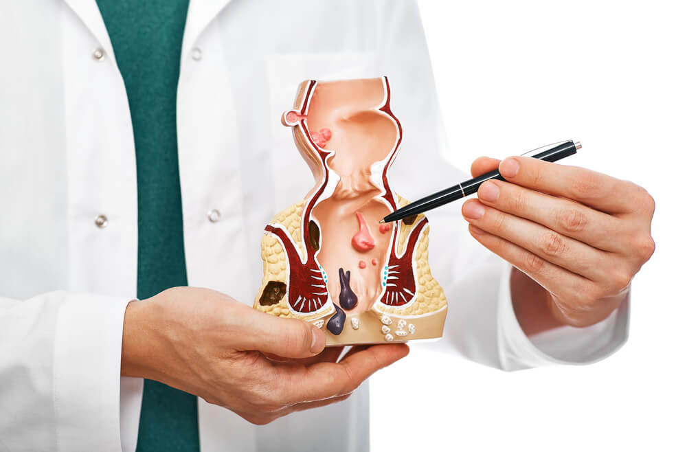Can Stress Cause Hemorrhoids?
