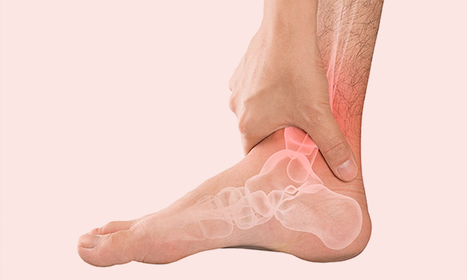 What Does a Stress Fracture Feel Like?